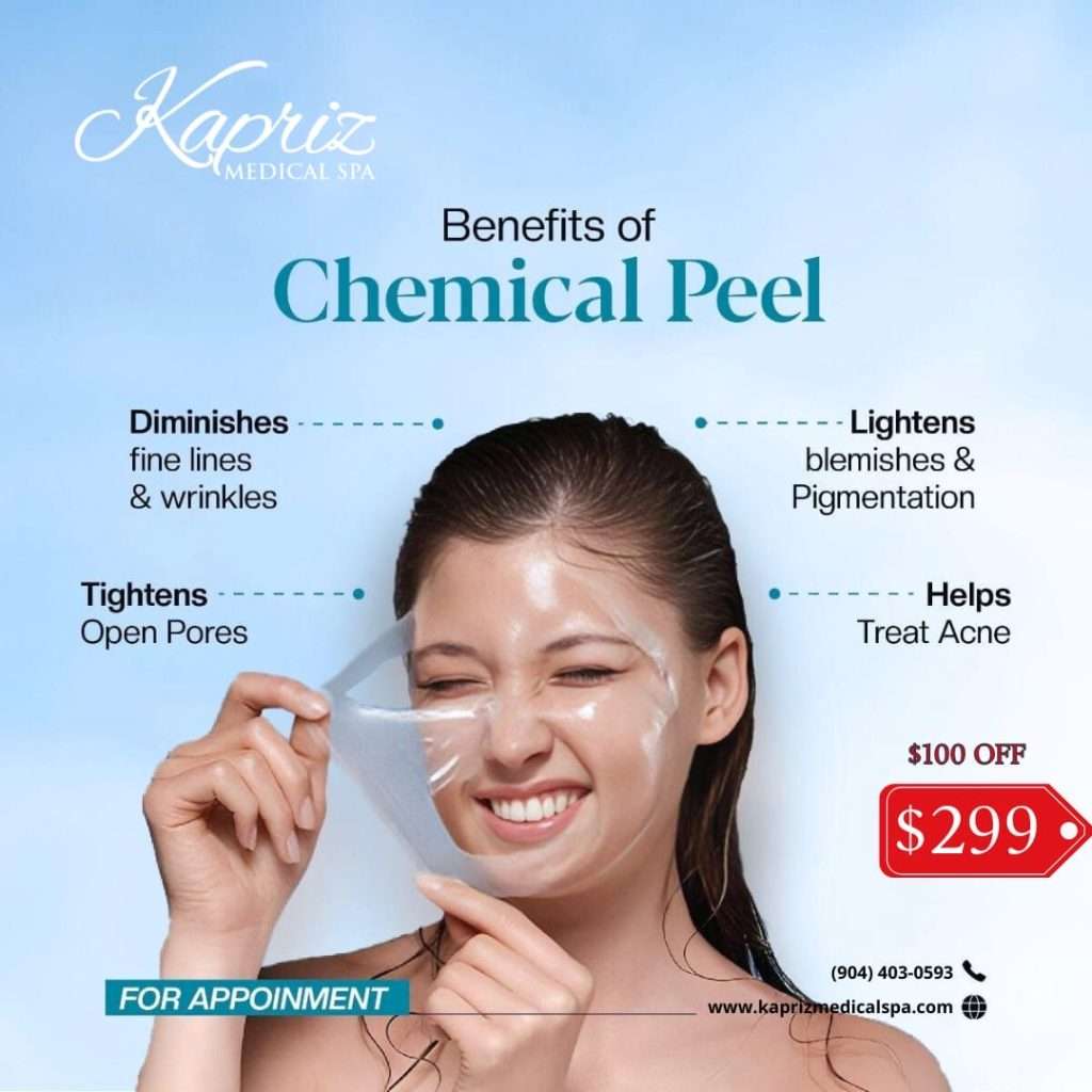 Chemical Peel Special 2025